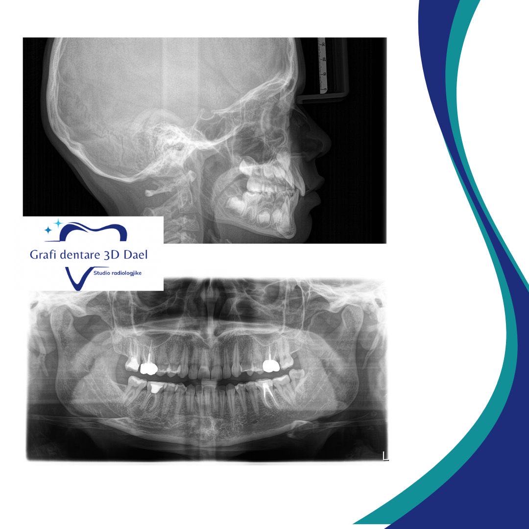 Grafi Dentale 3D Dael