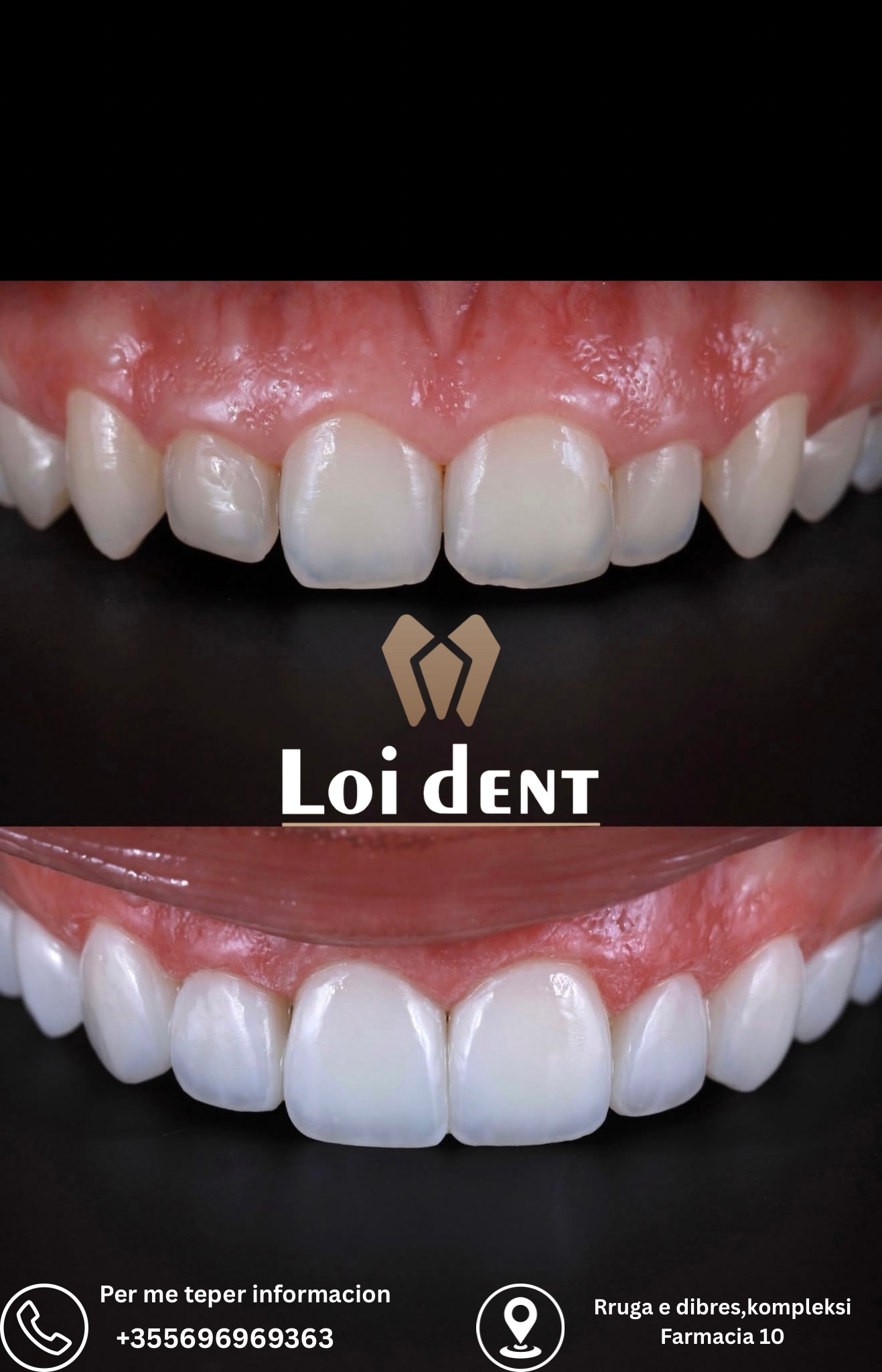 Loi Dent