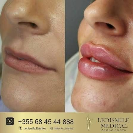 Ledi Medspa